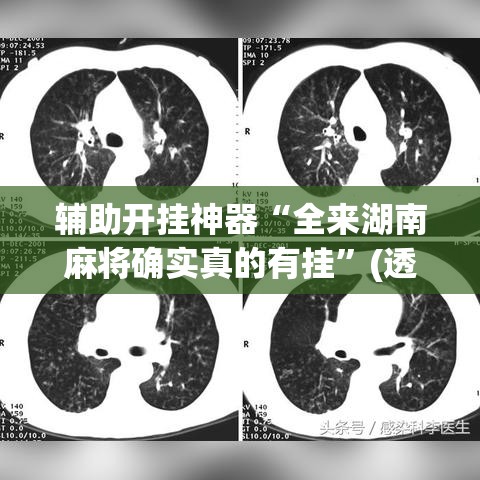 辅助开挂神器“全来湖南麻将确实真的有挂”(透视挂)辅助透视教程